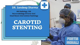 Carotid Stenting [upl. by Dagny412]