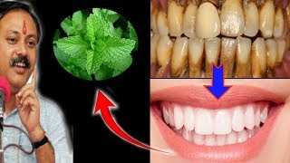 Magical Teeth whitening home remedy get whitening teeth at home in 5 minutes [upl. by Aihsetal215]