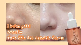 ⚡Quick Review 1 Avoskin Your Skin Bae Azeclair 10  Kombucha 3  Niacinamide 25 Vaccine Serum [upl. by Allekram]