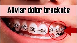 7 formas de aliviar el dolor por brackets [upl. by Aivlis]