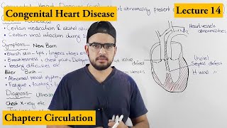 Congenital Heart Diseases Cardiovascular Disorders  Chapter Circulation video  14 [upl. by Gaynor38]