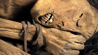 Mummies scanning ancient human remains [upl. by Elena]