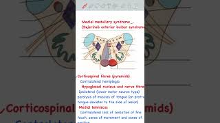 Medial Medullary Syndrome usmlestep usmlepreparation usmlestep1 [upl. by Fleck427]