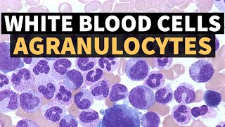 WHITE BLOOD CELLS  AGRANULOCYTES  DrSonu Yadav  Pathology Kingdom  Haematology [upl. by Gaudette602]