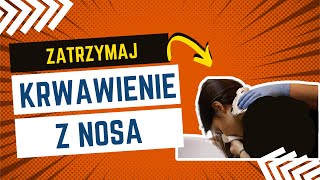 Krwawienie z nosa Pierwsza Pomoc🚨 krwawienieznosa [upl. by Lyndes]