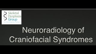 Neuroradiology of Craniofacial Syndromes craniosynostosis and beyond [upl. by Ebocaj864]