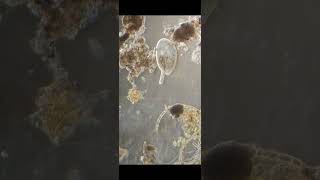 Frontonia poops a diatom aquarium science microscope nature biology [upl. by Nalyr909]