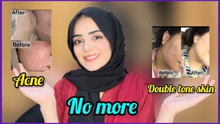 Say Good Bye To Acne And Double Tone Skin  Winter Skin Care Routine  Dietitian Aqsa [upl. by Stent671]