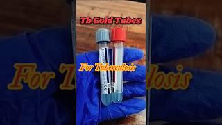 Tb Gold TubesTb Gold sample collection tubesTuberculosis test youtubeshorts shorts tranding [upl. by Pessa553]