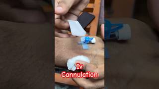 Iv cannulation  cannula doctor baby ivcannulation SMpharmacy subscribe [upl. by Nelluc]