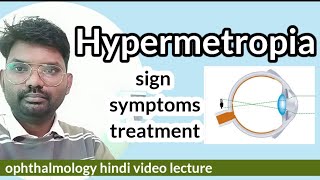 hypermetropia  what is hypermetropia  hypermetropia symptoms  optometryhindispecial  eye [upl. by Gabriel]