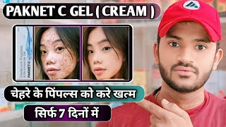 Paknet c gel uses dose benefits and Side effects full review in hindi [upl. by Callery]