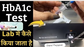 HbA1c test full procedureHbA1c test कैसे किया जाता हैं HbA1c test by SD BIOSENSER f200 Dr Gopal [upl. by Alburg]