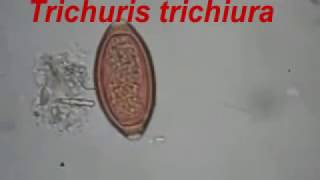 Trichuris trichiura and Ascaris lumbricoides [upl. by Andriana]