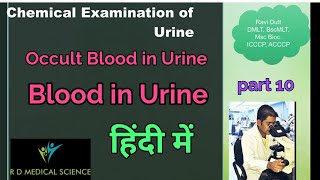 Blood in UrineOccult blood कारणchemical Examination ofurineBenzidine method of OB [upl. by Yerocaj]