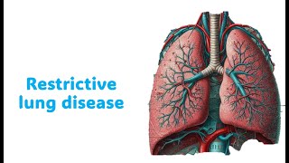 Enfermedades restrictivas pulmonares [upl. by Acirdna]