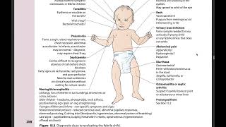 MRCPCH FOPTAS  READ ALONG CHAPTER 15 INFECTION amp IMMUNITY 1 ILLUSTRATED TEXTBOOK OF PEDIATRICS [upl. by Ahsimed]