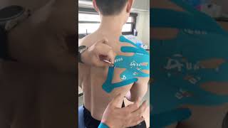 How to Use a More Holistic Kinesiology Taping Approach to Treating Painful Shoulder Injuries？ [upl. by Heyes]