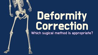 Deformity correction  How to know the appropriate surgical method [upl. by Ayatnahs]