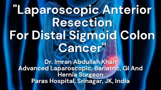 Laparoscopic Anterior Resection  Laparoscopic Cancer Surgery  Dr Imran Abdullah Khan [upl. by Un]