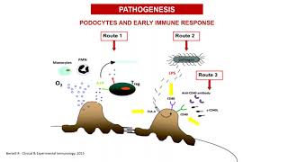 ERKNetEraEDTA Webinar  Rituximamb as a frontline therapy for adultonset minimal change disease [upl. by Yanrahs]