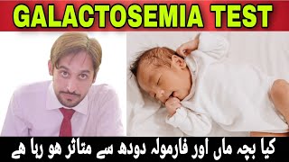 Galactosemia Test  Galactosemia Disease  Galactosemia Kya Hai [upl. by Vikky]