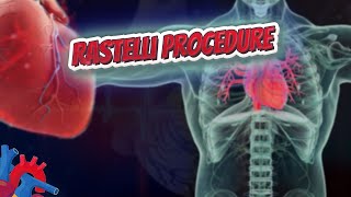 Rastelli procedure  Human Heart and Cardiology ❤️❤️❤️🔊✅ [upl. by Naihtsirc702]