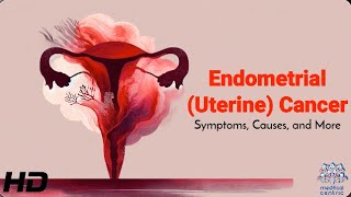 Endometrial Uterine Cancer Early Warning Signs You Shouldnt Ignore [upl. by Murielle]