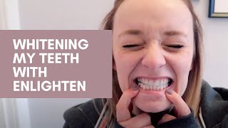 Whitening My Teeth with Enlighten [upl. by Lezley173]