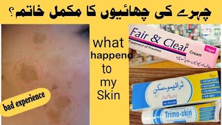 Trimo skin cream and Fair amp clear cream review  My personal experience [upl. by Lebiralc]