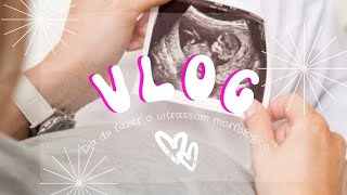 Vlog Dia de fazer o ultrassom morfológico [upl. by Aicen]