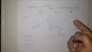 Endocrine Pathology  Hashimotos Thyroiditis  Diffuse amp Toxic Multinodular Goiter [upl. by Andeee]