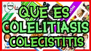 QUÉ ES COLELITIASIS Y COLECISTITIS  GuiaMed [upl. by Namqul]