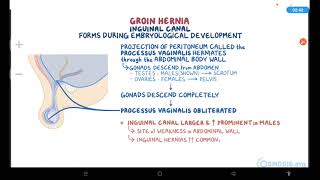 Abdominal Hernias  Osmosis [upl. by Solram]