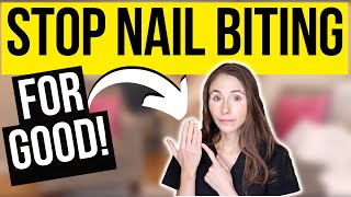 How To Stop Biting Your Nails For Good  Dermatologist Tips [upl. by Mollie850]