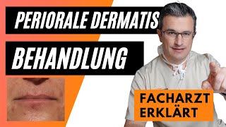 Periorale Dermatitis Behandlung Pflege Make up Nulltherapie perioraledermatitisbehandlung [upl. by Nadnerb]