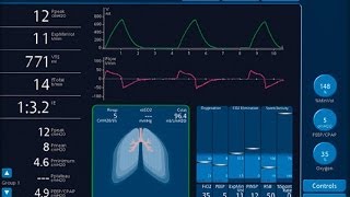 How does a ventilator works [upl. by Yoreel]