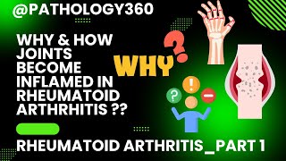 Rheumatoid arthritisRA part 1 What causes RA Concept of RA Simplified RA medicine md [upl. by Htebzil407]