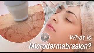 What is Microdermabrasion 3D Animation Video Explains [upl. by Yelats]