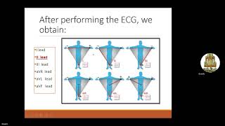 practical physiology ECG LAB [upl. by Hamimej46]