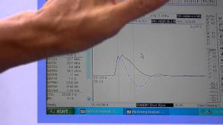 PDA Test Result Explanation [upl. by Arimahs]