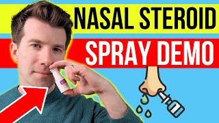 How to use STEROID NASAL SPRAY MEDICATION  Doctor demonstrates plus side effects [upl. by Norabal503]