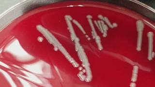 Microbiology Normal flora versus Pathogens [upl. by Ayor]