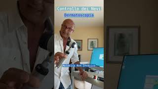 Controllo dei Nevi in Dermatoscopia dermatoscopia dermatologia epiluminescenza [upl. by Binky]