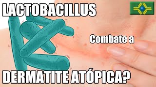 É verdade que o LACTOBACILLUS funciona igual uma VACINA DE ALERGIA para tratar a DERMATITE ATÓPICA [upl. by Narah]