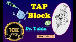 The UltrasoundGuided TAP Block [upl. by Noami388]