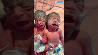 Newborn baby video medical viralvideo [upl. by Arraes]