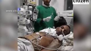 Ananda Wedisinghe In ICU [upl. by Elene]