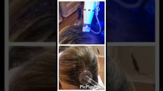 quotExclusive Hair Restoration for Women Thinning Hair Solutions by Eva Taubquot [upl. by Grace894]