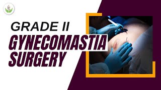 How Grade 2 Gynecomastia Surgery Can Help Restore Your Confidence  Care Well Medical Centre [upl. by Inahpets]